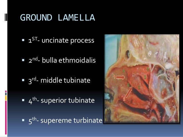 Endoscopic Anatomy of the Paranasal Sinuses